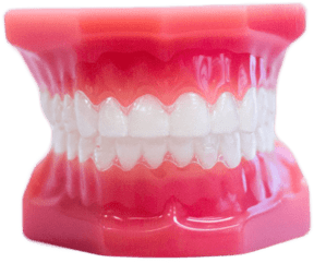 Clear Aligners